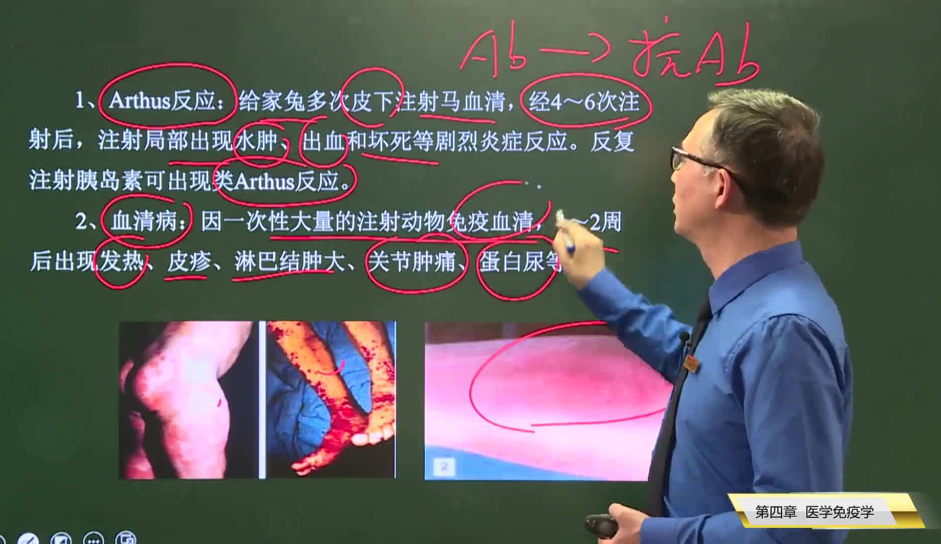 金英杰远程授课