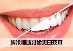 纳米釉质牙齿美白技术