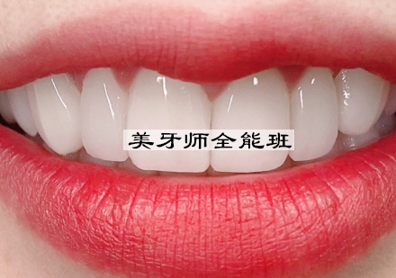 杭州美牙师全能班